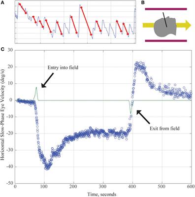 Magnetic Vestibular Stimulation (MVS) As a Technique for Understanding the Normal and Diseased Labyrinth